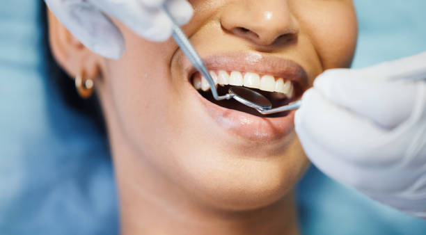 Best Knocked-Out Tooth Emergency  in Lwa, CA